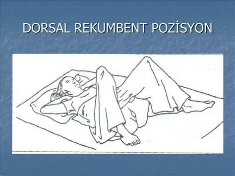 dorsal rekümbent pozisyonu nedir
